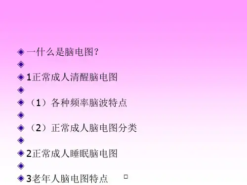 脑电图基本知识