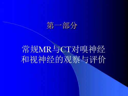 各条颅神经清晰MRI影像1