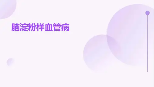 《脑淀粉样血管病》课件