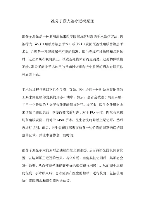 准分子激光治疗近视原理