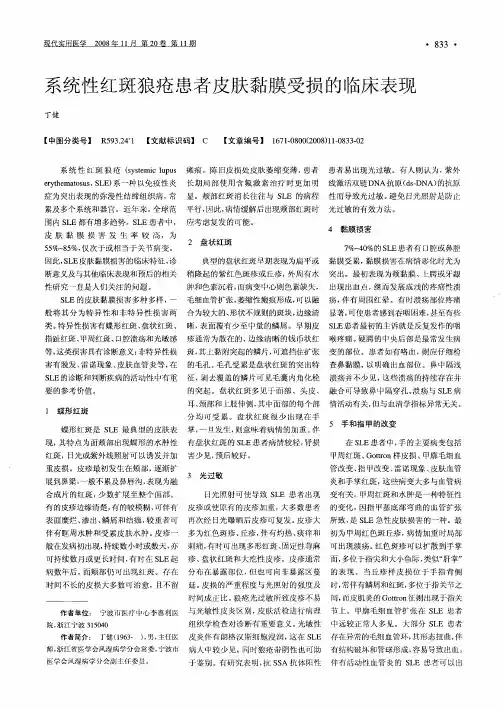 系统性红斑狼疮患者皮肤黏膜受损的临床表现