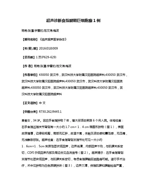 超声诊断食指腱鞘巨细胞瘤1例