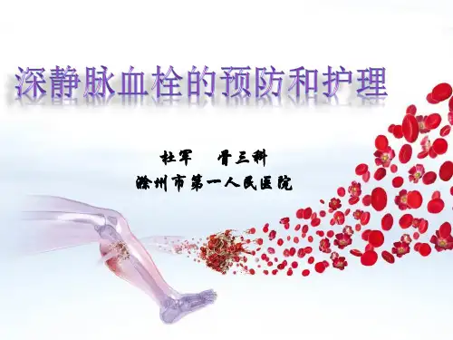 DVT的预防与护理