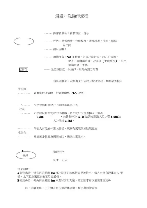 眼科滴泪道冲洗操作流程