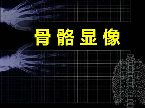 核医学：骨骼显像