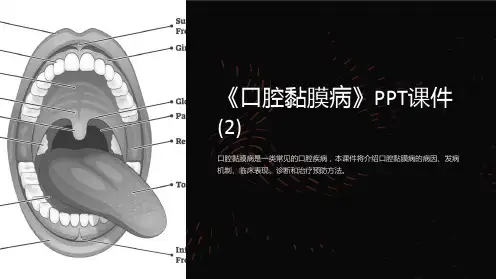 《口腔黏膜病》课件 (2)