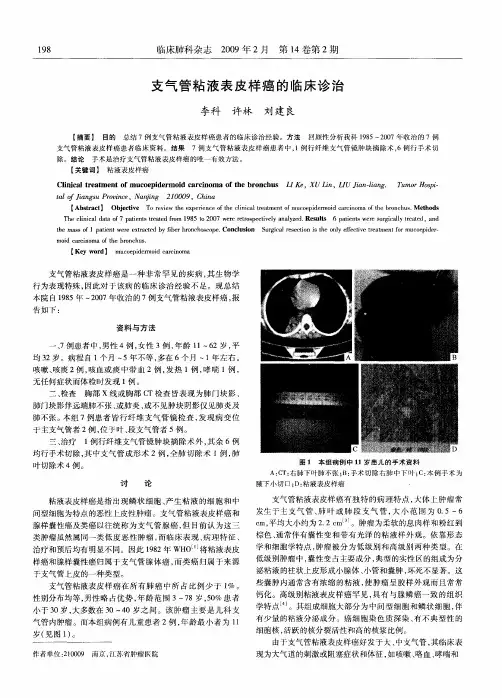 支气管粘液表皮样癌的临床诊治