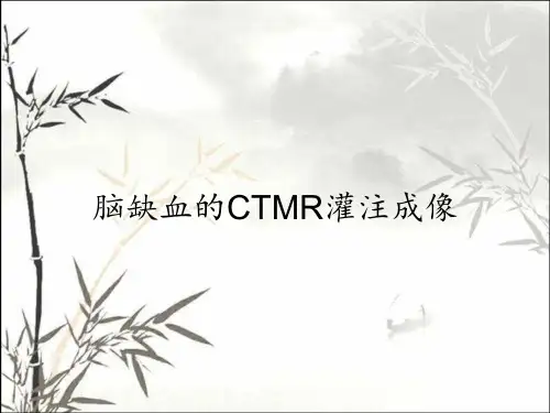 脑缺血的CTMR灌注成像