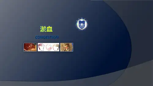 3.1.2 淤血