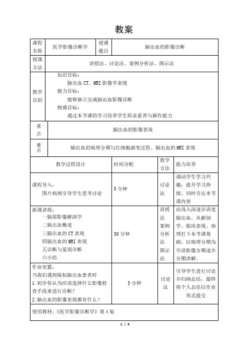 脑出血的影像诊断教案