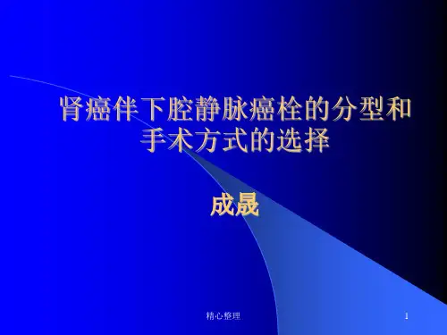 肾癌瘤栓Mayo分级最终版.ppt