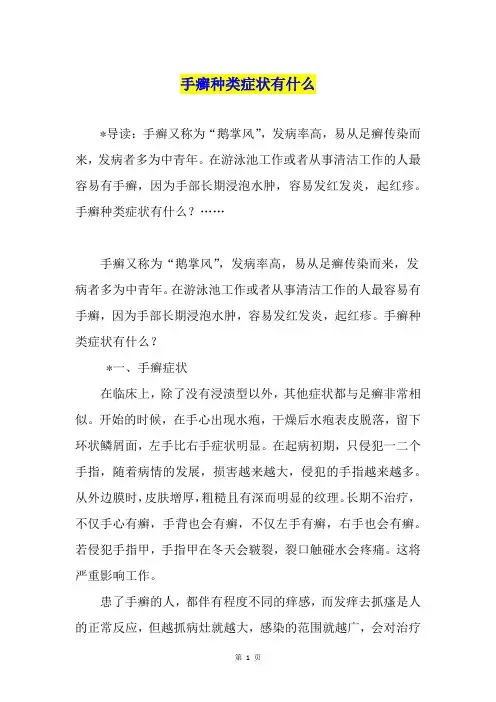 手癣种类症状有什么