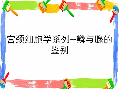 宫颈细胞学系列--鳞与腺的鉴别