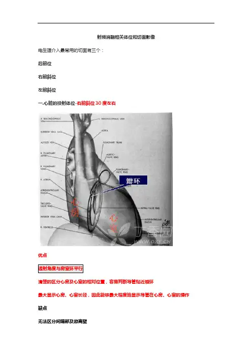 射频消融相关体位和切面影像