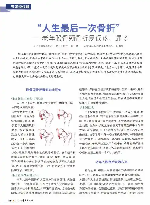 “人生最后一次骨折”——老年股骨颈骨折易误诊、漏诊