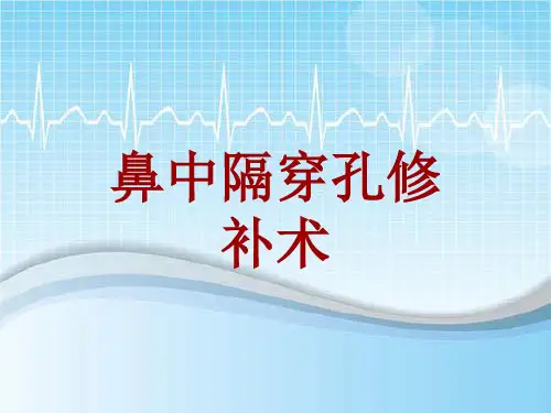 手术讲解模板：鼻中隔穿孔修补术
