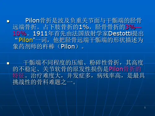 PiLon骨折诊断治疗ppt课件
