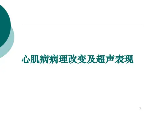 心肌病病理改变及超声表现