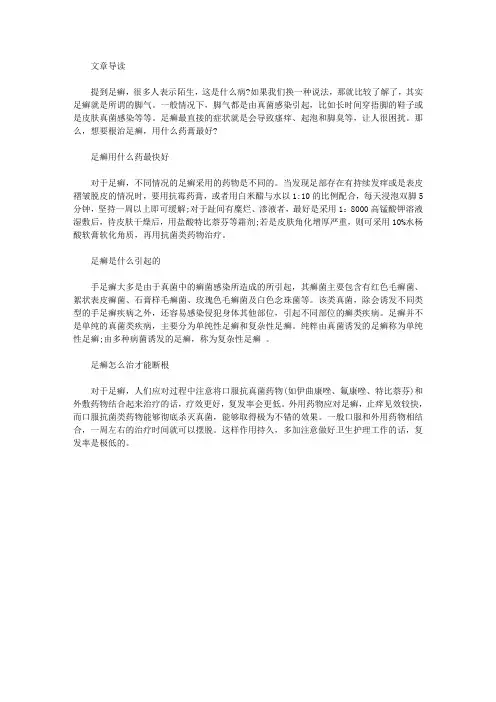 足藓用什么药膏治疗