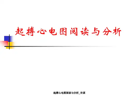 起搏心电图阅读与分析_许原