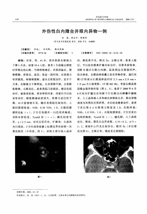 外伤性白内障合并眼内异物一例
