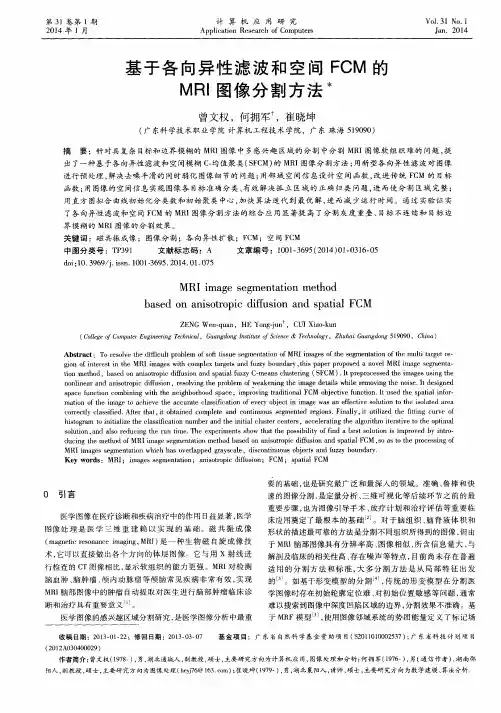 基于各向异性滤波和空间FCM的MRI图像分割方法