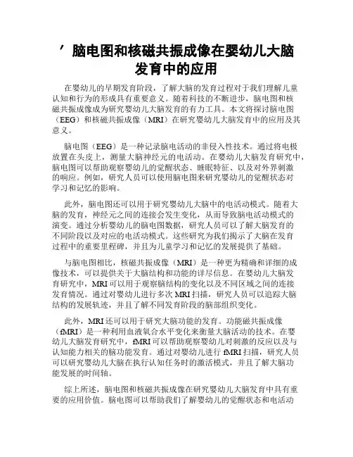 ′脑电图和核磁共振成像在婴幼儿大脑发育中的应用