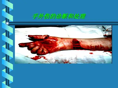 手外伤的诊断和处理课件
