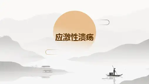 应激性溃疡PPT