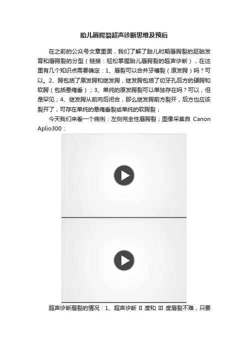胎儿唇腭裂超声诊断思维及预后