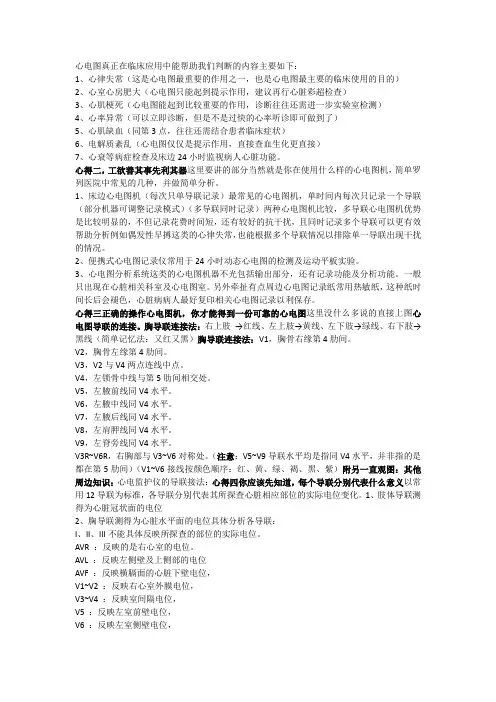 心电图分析方法