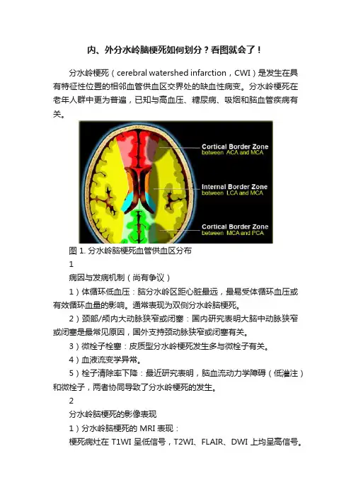 内、外分水岭脑梗死如何划分？看图就会了！