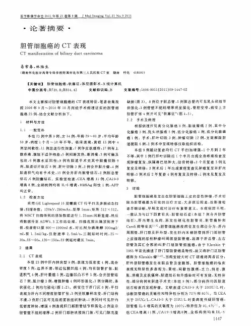 胆管细胞癌的CT表现