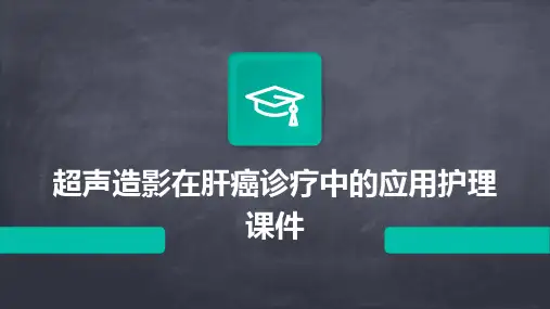 超声造影在肝癌诊疗中的应用护理课件