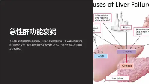 急性肝功能衰竭