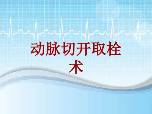 手术讲解模板：动脉切开取栓术