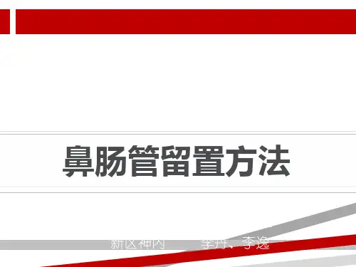 鼻肠管留置方法.ppt