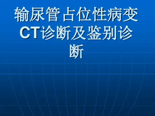 输尿管占位性病变CT诊断及鉴别诊断