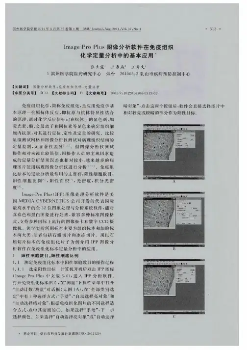 Image-Pro Plus图像分析软件在免疫组织化学定量分析中的基本应用