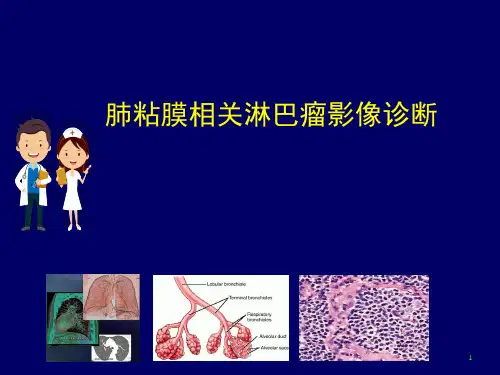 肺粘膜相关淋巴瘤影像特征PPT参考课件