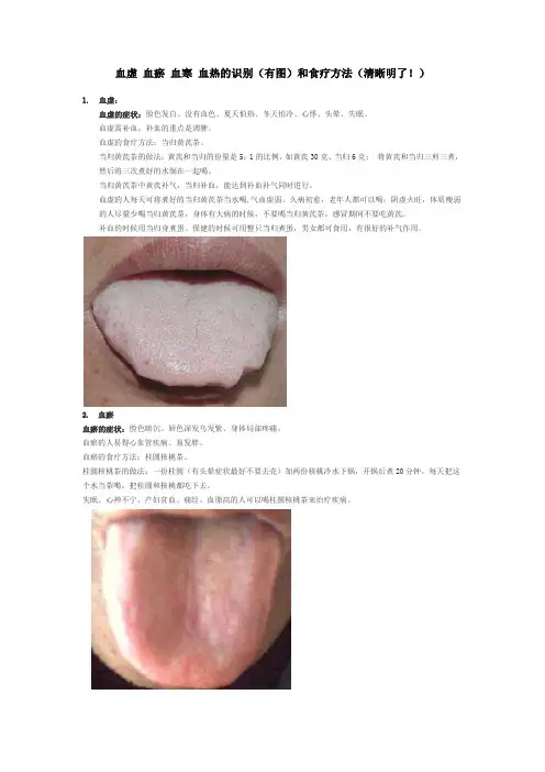 血虚 血瘀 血寒 血热的识别(有图)和食疗方法(清晰明了!)