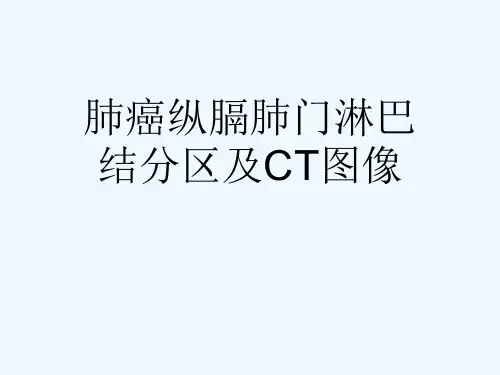 肺癌纵膈肺门淋巴结分区及CT图像[可修改版ppt]