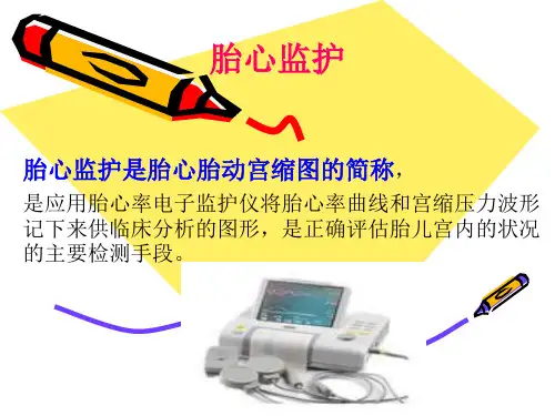 胎心监护课件详解PPT课件