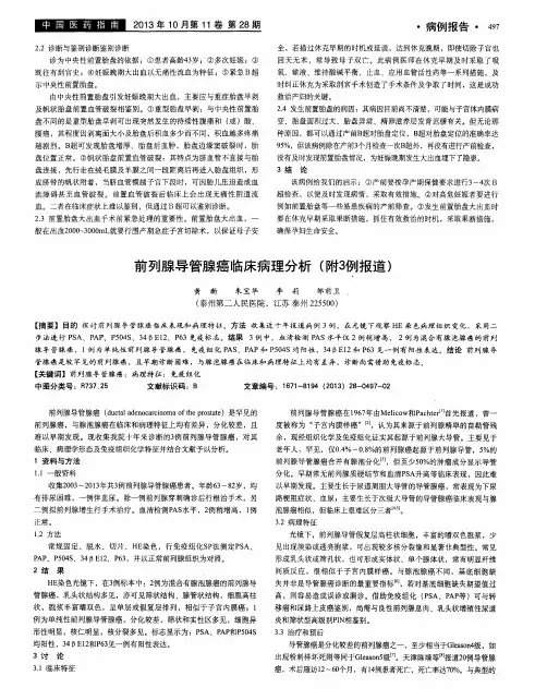 前列腺导管腺癌临床病理分析(附3例报道)