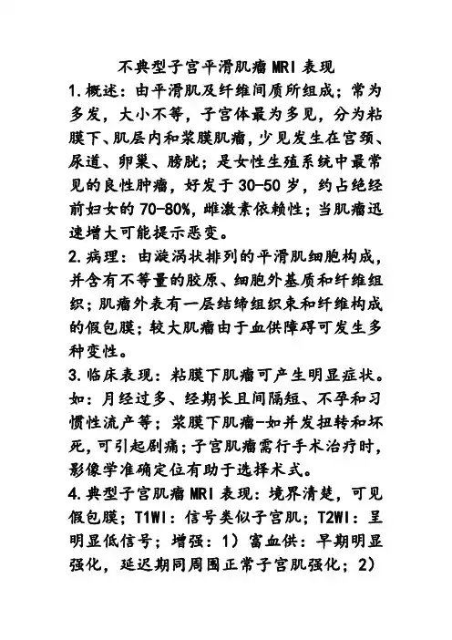 不典型子宫平滑肌瘤MRI影像