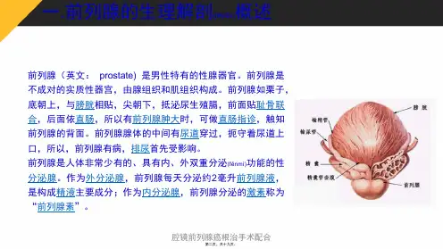 腔镜前列腺癌根治手术配合课件