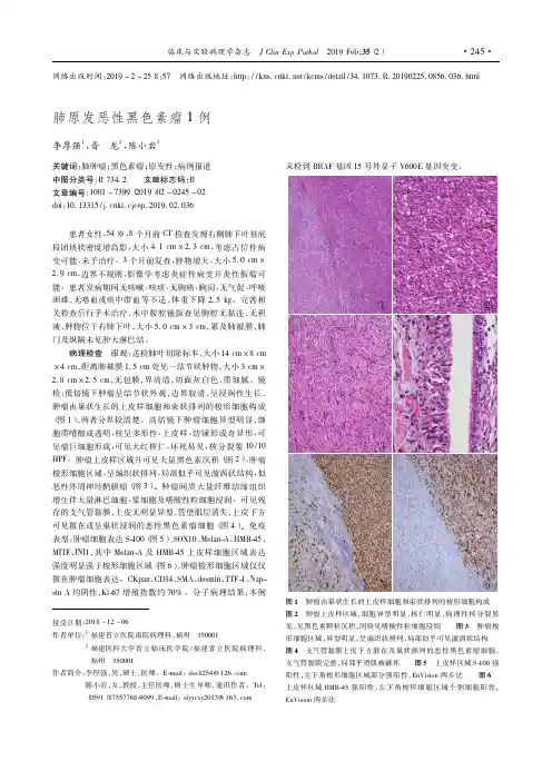 肺原发恶性黑色素瘤1例