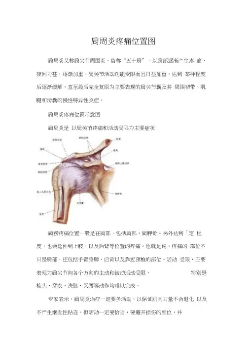 肩周炎疼痛位置图