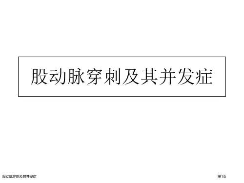 股动脉穿刺及其并发症