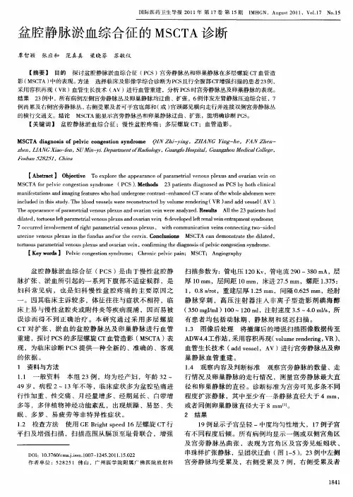 盆腔静脉淤血综合征的MSCTA诊断